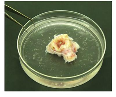 In vitro Methods for the Development and Analysis of Human Primary Airway Epithelia